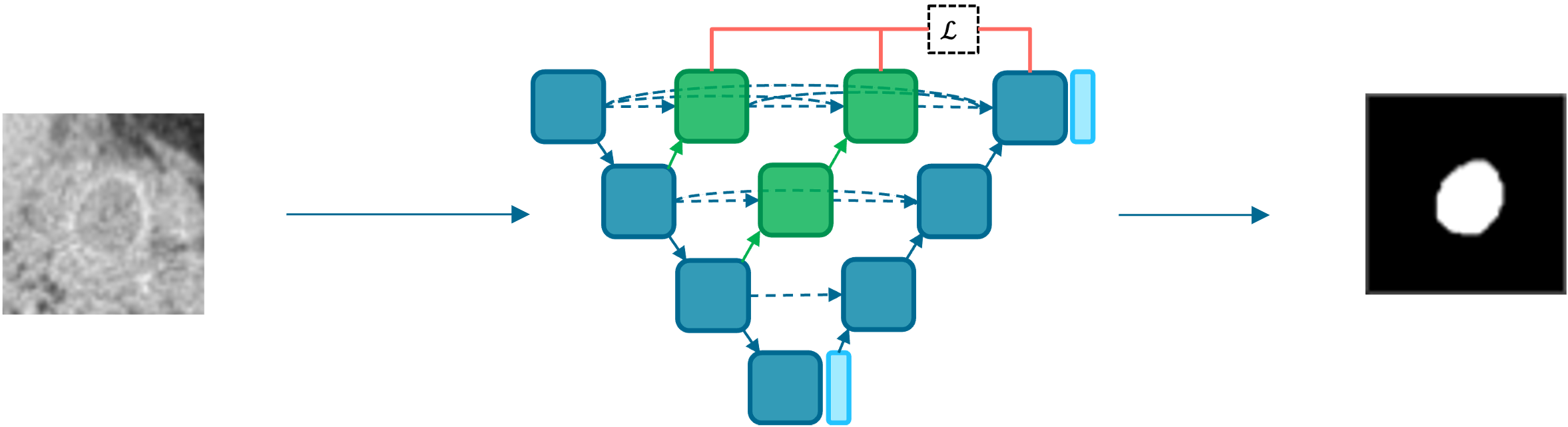 Tumor segmentation